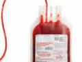 रक्त विलगीकरण सुविधा नाही - Marathi News | There is no blood transfusion facility | Latest maharashtra News at Lokmat.com