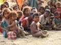 कुपोषण समस्या जैसे थे! - Marathi News | Malnutrition problems were like! | Latest mumbai News at Lokmat.com