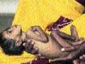 लाखावर बालके तपासणीपासून वंचित! - Marathi News | Lakhav children deprived! | Latest chhatrapati-sambhajinagar News at Lokmat.com