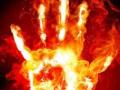 भाजलेल्या २४ टक्के रुग्णांचा मृत्यू - Marathi News | 24 percent of patients suffering from burns | Latest chhatrapati-sambhajinagar News at Lokmat.com