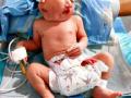 खामगावात दोन तोंडी बालकाचा जन्म - Marathi News | The birth of two oral baby in Khamgaon | Latest maharashtra News at Lokmat.com
