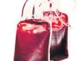 रक्तपेढ्यांमध्ये प्लेटलेटचा तुटवडा - Marathi News | Platonic scarcity in blood banks | Latest nagpur News at Lokmat.com