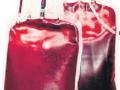 रक्तगटाच्या प्लेटलेटस्चा तुटवडा - Marathi News | Scarcity of platelet platelets | Latest nagpur News at Lokmat.com