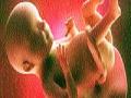 स्टेम सेलच्या माध्यमातून गर्भातच उपचार - Marathi News | Treatment in the womb through stem cells | Latest international News at Lokmat.com