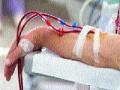 डायलेसिसचा खर्च परवडेना! - Marathi News | Do not spend the cost of dialysis! | Latest mumbai News at Lokmat.com