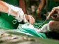 अमेरिकेत पहिल्यांदाच होणार गुप्तांगाचे प्रत्यारोपण - Marathi News | For the first time in the United States, the genital herpes transplant | Latest international News at Lokmat.com