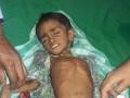 कुपोषणाला जाबाबदार कुटुंबच, जव्हारमधील घटना.. - Marathi News | Family of malnutrition, incident in Jawhar .. | Latest maharashtra News at Lokmat.com