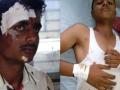 बुलढाण्यात शिस्तसेवकांचा ट्रॅक्टर उलटून १२ जखमी - Marathi News | Shinde Sevak's tractor turns 12 injured in Buldhana | Latest maharashtra News at Lokmat.com