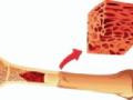 देशातील पहिले बोन मॅरो रजिस्ट्री मेडिकलमध्ये - Marathi News | In the country's first bone marrow Registry Medical | Latest nagpur News at Lokmat.com