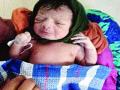 पित्याच्या अवयवदानाप्रसंगी कन्येचा जन्म - Marathi News | Birth of a daughter in the form of father's organs | Latest maharashtra News at Lokmat.com