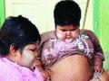 ४० टक्के मुलांचा लठ्ठपणा आनुवंशिक - Marathi News | 40 percent of children obesity genetic | Latest maharashtra News at Lokmat.com