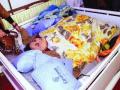 इमानला दोन पक्षाघाताचे झटके - Marathi News | Two paralyzed tremors for Iman | Latest maharashtra News at Lokmat.com