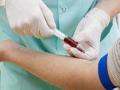 आता वैद्यकीय चाचण्याही निम्म्या किमतीत - Marathi News | Now at half the cost of medical tests | Latest maharashtra News at Lokmat.com