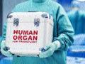 पोलीस पडताळणीशिवायच अवयव प्रत्यारोपण - Marathi News | Organ transplant without police verification | Latest pune News at Lokmat.com