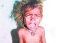कुपोषित मुलांना पेस्ट पॅकेट नको! - Marathi News | Malnourished children do not want a paste packet! | Latest maharashtra News at Lokmat.com