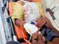 विजेच्या झटक्याने विद्यार्थी जखमी - Marathi News | Student wounded by electric shock | Latest chandrapur News at Lokmat.com