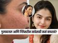 गुलाबजल-ग्लिसरीन ‘या’ पद्धतीने चेहऱ्याला लावा, ओपन पोर्स आणि पिगमेंटेशन चटकन होईल कमी - Marathi News | how to get rid of open pores and pigmentation, home remedies for dry skin, home hacks for dark circles and dark lips  | Latest sakhi News at Lokmat.com