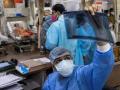 कोरोना डेथ ऑडिट: ५६ टक्के रुग्णांना आधीपासूनच आजार - Marathi News | Corona Death Audit: 56% of patients already have the disease | Latest akola News at Lokmat.com