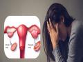 लठ्ठपणा ठरतोय '' पीसीओडी'' ला कारणीभूत - Marathi News | increase in uterine related problems due to fats | Latest maharashtra News at Lokmat.com