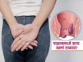 नाजुक जागेचं दुखणं म्हणजे पाइल्स असेल तर काय अजिबात खाऊ नये? प्रचंड वेदना टाळण्याचा सोपा उपाय - Marathi News | What to avoid in when you have piles | Latest sakhi News at Lokmat.com