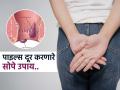 पाइल्सचा त्रास कमी करणारे सोपे घरगुती उपाय; सर्जरीची वेळ येण्यापूर्वी बदला ‘या’ सवयी - Marathi News | Harvard doctor tells easy home remedies to get rid piles | Latest sakhi Photos at Lokmat.com