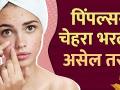काय केल्याने पिंपल्स कमी होतील | How To Remove Pimples Overnight | Pimples Removal Treatment - Marathi News | What to do to reduce pimples | How To Remove Pimples Overnight | Pimples Removal Treatment | Latest beauty Videos at Lokmat.com