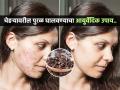 चेहऱ्यावरील पुरळ, डाग गायब करण्याचा रामबाण उपाय, ७ दिवसात चेहरा होईल चमकदार... - Marathi News | Nutritionist Shweta Shah tells ayurvedic remedy for clear skin | Latest sakhi News at Lokmat.com