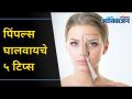 Dry Skin कशी चांगली कराल | 5 Skincare Tips | How To Get Rid Of Pimples During Periods? - Marathi News | How to make dry skin better | 5 Skincare Tips | How To Get Rid Of Pimples During Periods? | Latest oxygen Videos at Lokmat.com