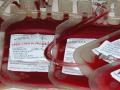 रक्तपेढ्यांमध्ये प्लेटलेट्सचा तुटवडा - Marathi News | Platelets shortfall in blood banks in Akola | Latest akola News at Lokmat.com