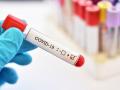 अकोला जिल्ह्यात आणखी ३० कोरोना पॉझिटिव्ह रुग्ण आढळले - Marathi News | Another 30 corona positive patients were found in Akola district | Latest akola News at Lokmat.com