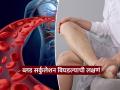 ब्लड सर्क्युलेशन बिघडलं तर पायांत दिसतात ‘ही’ ३ लक्षणं, पाहा तुमचे पाय असे तर दिसत नाहीत.. - Marathi News | These 3 symptoms appear in the legs if blood circulation is poor | Latest sakhi News at Lokmat.com