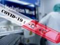 CoronaVirus in Akola : आणखी १५  कोरोना पॉझिटिव्ह रुग्ण आढळले - Marathi News | Coronavirus in Akola: 15 more corona positive patients found | Latest akola News at Lokmat.com