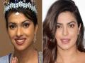 प्लॅस्टिक सर्जरीआधी अशा दिसायच्या 'या' बॉलिवूड अभिनेत्री! - Marathi News | Bollywood Actress before and after Plastic Surgery | Latest beauty News at Lokmat.com