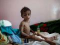 कुपोषण नियंत्रणासाठी व्हीसीडीसी सुरू करा - Marathi News | Start the VCDDC to control malnutrition | Latest raigad News at Lokmat.com