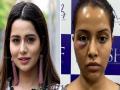 SHOCKING : चुकीच्या औषधांमुळे बिघडला या अभिनेत्रीचा चेहरा; पोस्ट वाचून बसेन धक्का - Marathi News | Raiza Wilson Beautiful Face Turns Dull After Wrong Treatment | Latest filmy News at Lokmat.com