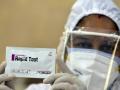 आता अतिजोखमीच्या व्यक्तींचीच होणार ‘रॅपिड अ‍ॅन्टीजन टेस्ट’! - Marathi News | High risk individuals will now have a 'Rapid Antigen Test'! | Latest akola News at Lokmat.com