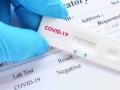 CoronaVirus in Nagpur : दिलासादायक! नागपुरात ४९,९४६ रुग्ण बरे - Marathi News | CoronaVirus in Nagpur: Comfortable! In Nagpur, 49,946 patients were cured | Latest nagpur News at Lokmat.com