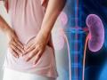 Know fastest ways to get rid of Kidney infection at home - Hindi News | Know fastest ways to get rid of Kidney infection at home | Latest health Photos at Lokmattimes.com