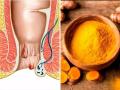 Get rid of piles with these home remedies - Hindi News | Get rid of piles with these home remedies | Latest health Photos at Lokmattimes.com