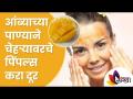 आंब्याच्या पाण्याने चेह-यावरचे पिंपल्स करा दूर | Mango Water Reduces Pimples | Lokmat Sakhi - Marathi News | Get rid of pimples on your face with mango water Mango Water Reduces Pimples | Lokmat Sakhi | Latest oxygen Videos at Lokmat.com