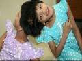 Telangana's Conjoined Twins Veena and Vani Pass Class 10 Exams, Parents Wants Them To Join IT Industry - Hindi News | Telangana's Conjoined Twins Veena and Vani Pass Class 10 Exams, Parents Wants Them To Join IT Industry | Latest national Photos at Lokmattimes.com