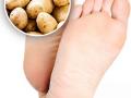टाचांना मोठ्या भेगा पडल्या-पावसाळ्यात ठणकतातही? कच्च्या बटाट्याचा उपाय- भेगांसाठी खास मलम... - Marathi News | Using potatoes for cracked heels No Dry, Cracked Heels. Rub a Potato Over Them atural Home Remedies for Cracked Heels | Latest sakhi News at Lokmat.com