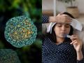 कोरोनानंतर आता Rift Valley Fever, WHO चा इशारा; काय आहेत आजाराची लक्षणे? - Marathi News | After Corona now Rift Valley Fever, WHO warning, What are the symptoms of the disease? | Latest health Photos at Lokmat.com