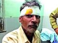 बिबट्याच्या हल्ल्यात शेतकरी जखमी  - Marathi News | Farmer injured in leopard attack | Latest buldhana News at Lokmat.com