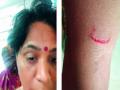 विद्यार्थिनींच्या भांडणातून पालकाची मुख्याध्यापिकेला जबर मारहाण - Marathi News | Parent's beats Head Master in Aurangabad | Latest chhatrapati-sambhajinagar News at Lokmat.com