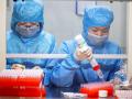 Coronavirus: कोरोनाच्या दहशतीखालीच जगावं लागणार; लस मिळण्याची हमी नाही, WHO तज्ज्ञाचा दावा - Marathi News | Coronavirus: must live under the terror of Corona; WHO expert claims no vaccine is guaranteed pnm | Latest international Photos at Lokmat.com