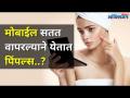 मोबाईल सतत वापरल्याने पिंपल्स येतात का? Mobile Phone Affects Skin | Causes Pimples | Lokmat Oxygen - Marathi News | Does constant use of mobile cause pimples? Mobile Phone Affects Skin | Causes Pimples I Lokmat Oxygen | Latest oxygen Videos at Lokmat.com