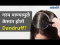 गरम पाण्यामुळे केसात होतो Dandruff? Washing Hair with hot water can cause Dandruff | Lokmat Oxygen - Marathi News | Hot water causes dandruff in hair? Washing Hair with hot water can cause Dandruff | Lokmat Oxygen | Latest oxygen Videos at Lokmat.com