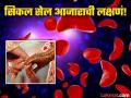 काय आहे सिकल सेल आजार? ज्यामुळे लग्न करू शकत नाहीयेत राजस्थानमधील काही लोक!  - Marathi News | What is sickle cell disease? know the symptoms and causes | Latest health News at Lokmat.com