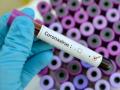 coronavirus: सिंधुदुर्ग जिल्ह्यात सक्रीय रुग्णांची संख्या ८० वर - Marathi News | The number of active corona patients in Sindhudurg district is over 80 | Latest sindhudurga News at Lokmat.com
